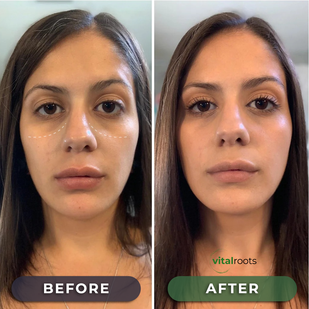 Vital Roots™ Oregano Oil with Black Seed Oil (6,000mg)